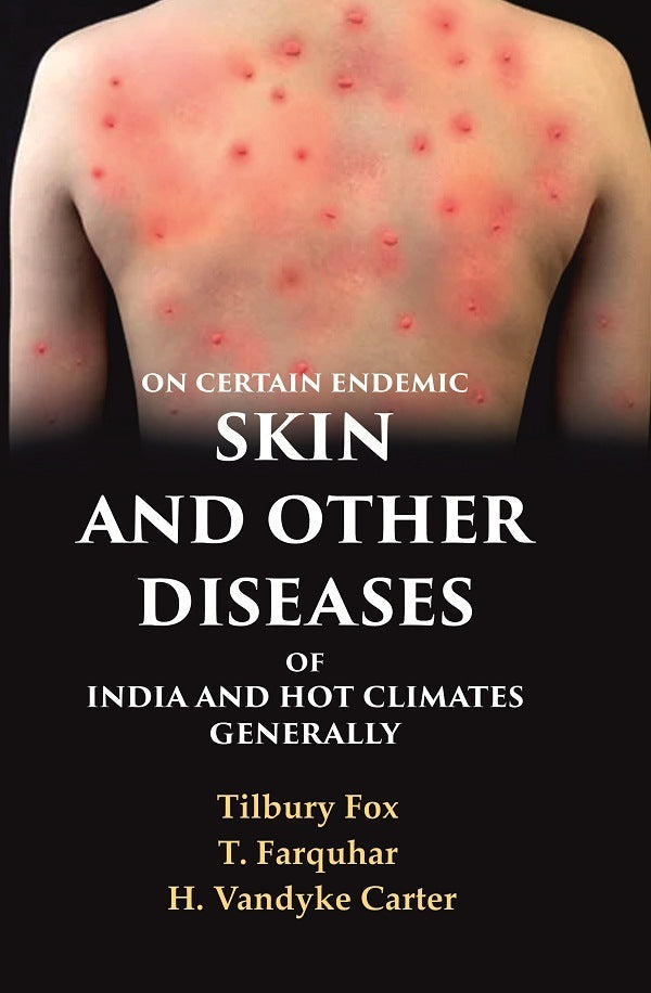 On Certain Endemic Skin and Other Diseases of India and Hot Climates Generally - Gyan Books