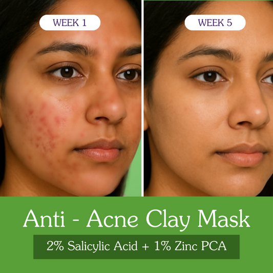 Bake 2% Salicylic Acid + Zinc PCA Anti-Acne Clay Mask - Combo | Swadesiicart