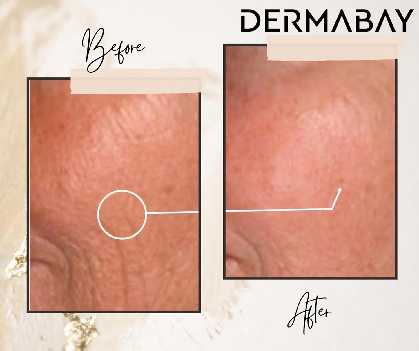 Dermabay Retinol 0.2% Face Serum | Swadesiicart