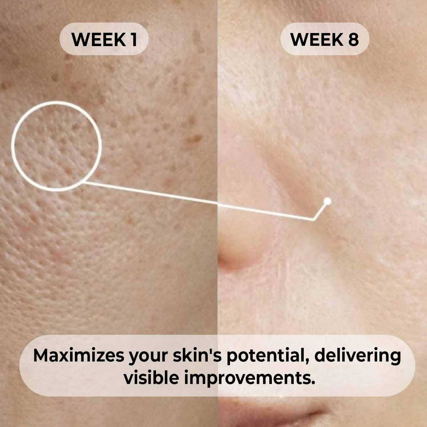 Dermabay Niacinamide 5%+ Hyaluronic acid 1% Serum | Swadesiicart