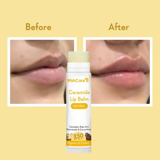Wishcare Ceramide Lip Balm with SPF50 PA+++ - Natural - Swadesiicart