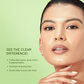Quench Clear Skin Serum With Matcha Green Tea | Swadesiicart