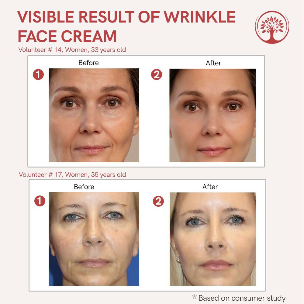 Ivory Natural Wrinkle Face Cream For More Radiant And Youthful Look | Swadesiicart