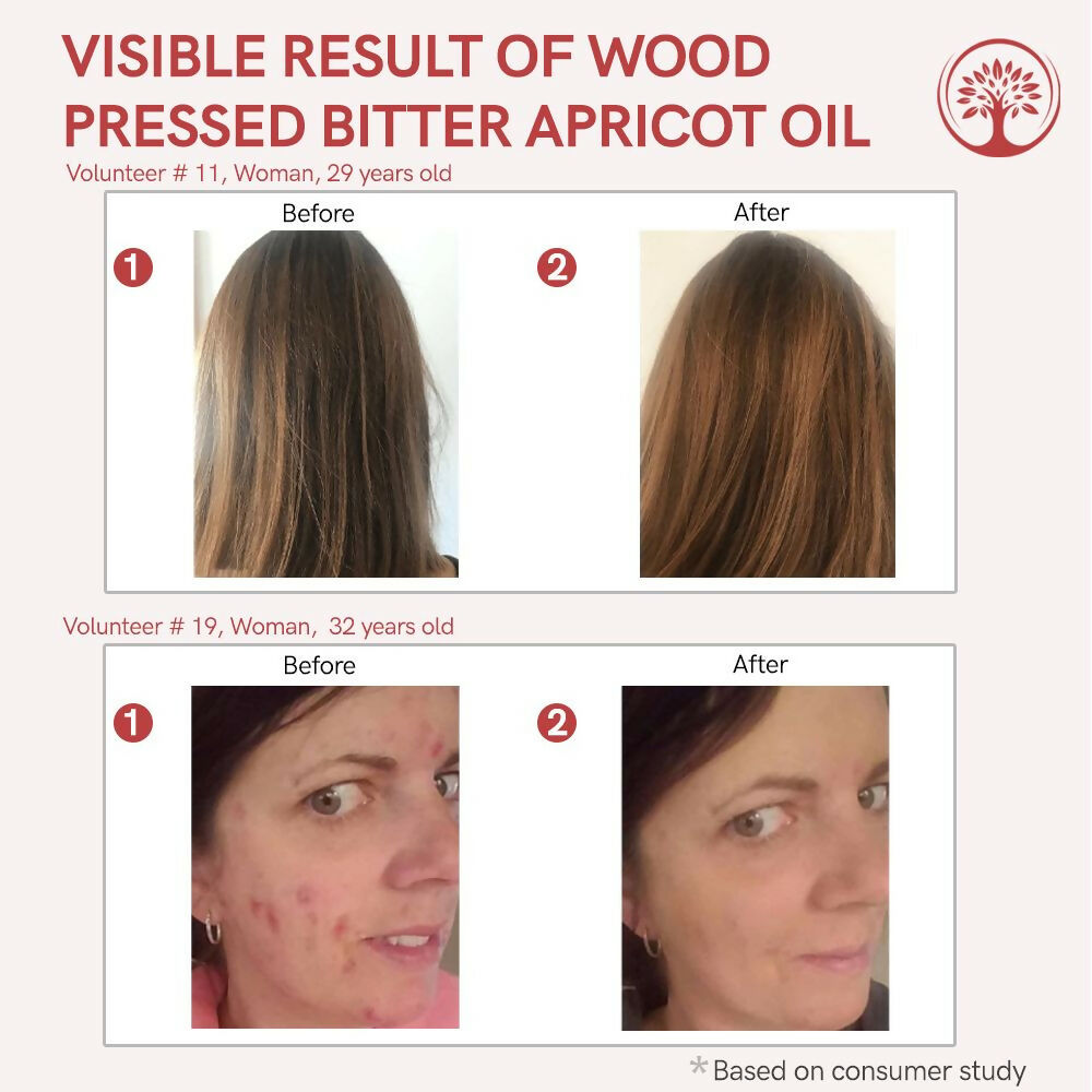 Ivory Natural Wood Pressed Bitter Apricot Oil Organic & Extra Virgin For Deep Moisturization, Gentle Hydration, And Youthful Glow | Swadesiicart