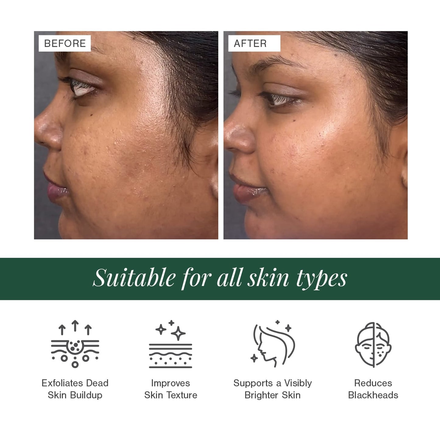 5% Lactic Acid + 3% Flower Acids Face Serum