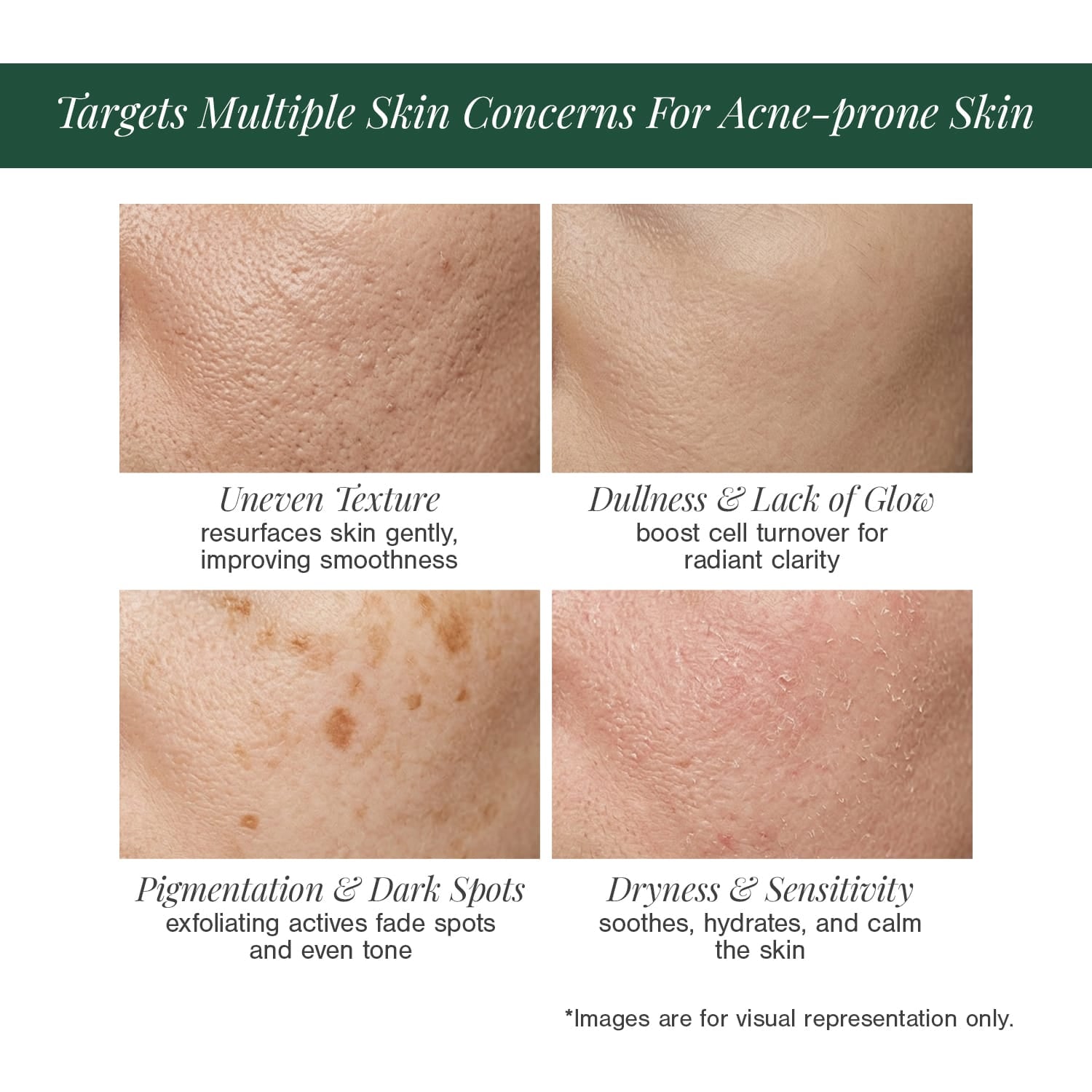 5% Lactic Acid + 3% Flower Acids Face Serum
