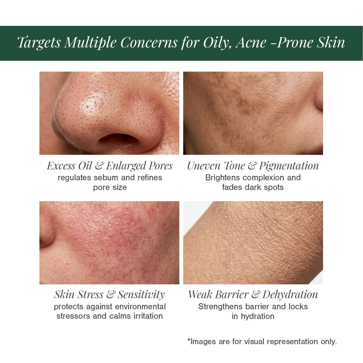 10% Niacinamide + 2% Ectoin Face Serum