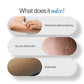 BeBodywise 20% Urea Body Lotion - Advanced Formulation
