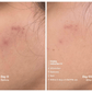 Awear Beauty Glass Skin Dual Spot Treatment
