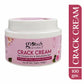 Globus Naturals Crack Cream Rose | Swadesiicart