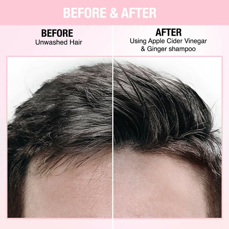 Nykaa Naturals Anti-Dandruff - Free Shampoo with Apple Cider Vinegar, Ginger & Tea Tree Oil - Swadesiicart