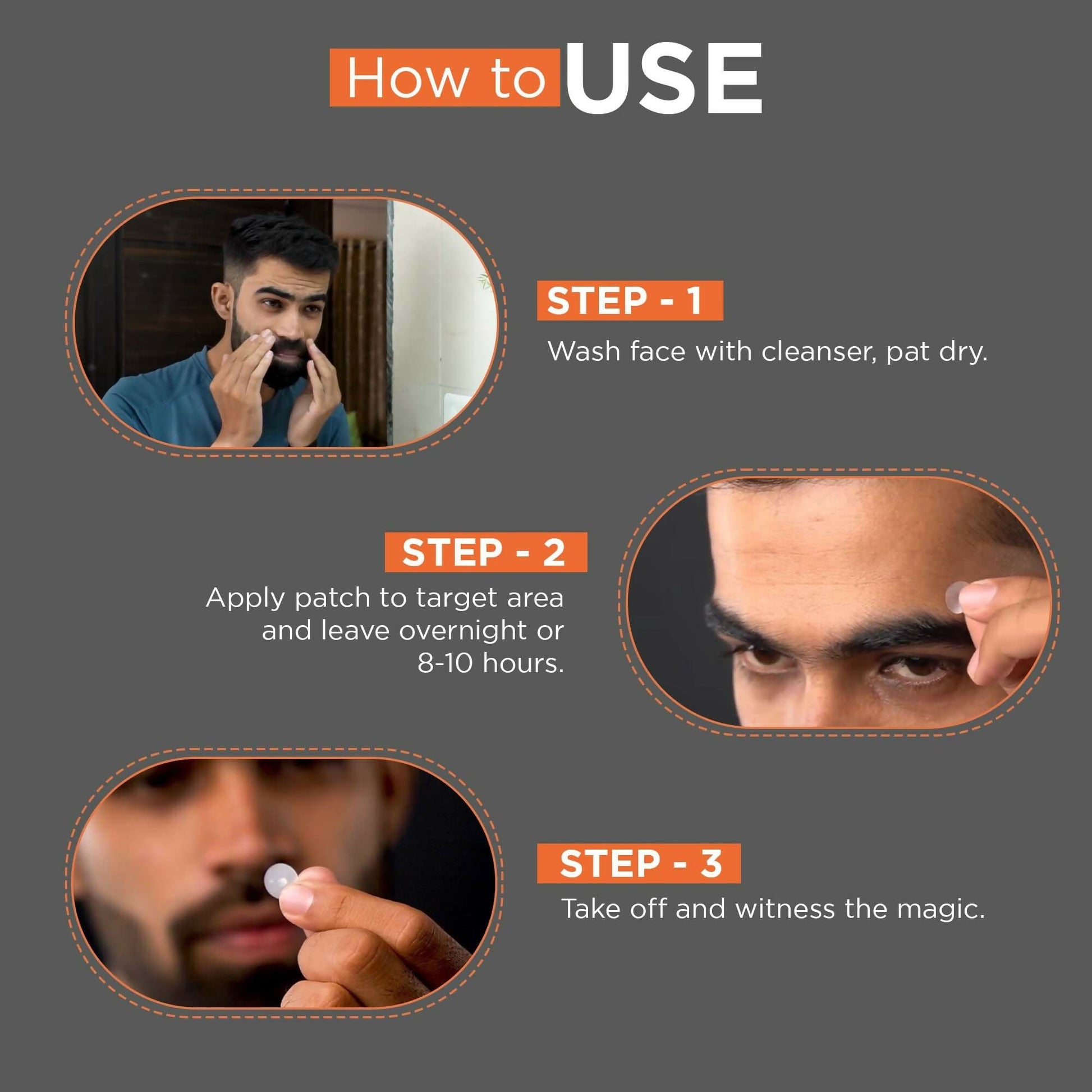 Beardhood Acne Pimple Patch Hydrocolloid Waterproof Patches For Active Surface Acne, Absorbs Pimple Overnight - Swadesiicart