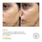 2% Alpha Arbutin + D-Gallic Acid Natural Face Serum