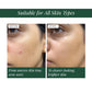 2% Alpha Arbutin + D-Gallic Acid Natural Face Serum