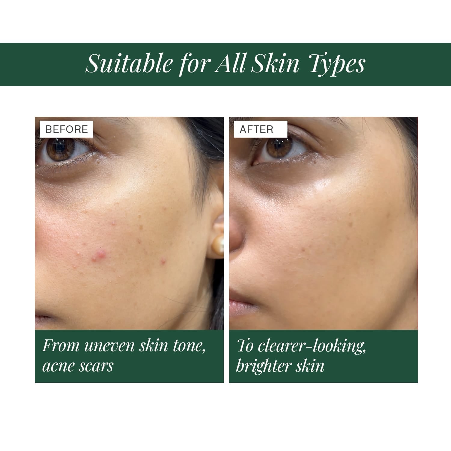 2% Alpha Arbutin + D-Gallic Acid Natural Face Serum