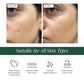 2% Alpha Arbutin + D-Gallic Acid Natural Face Serum