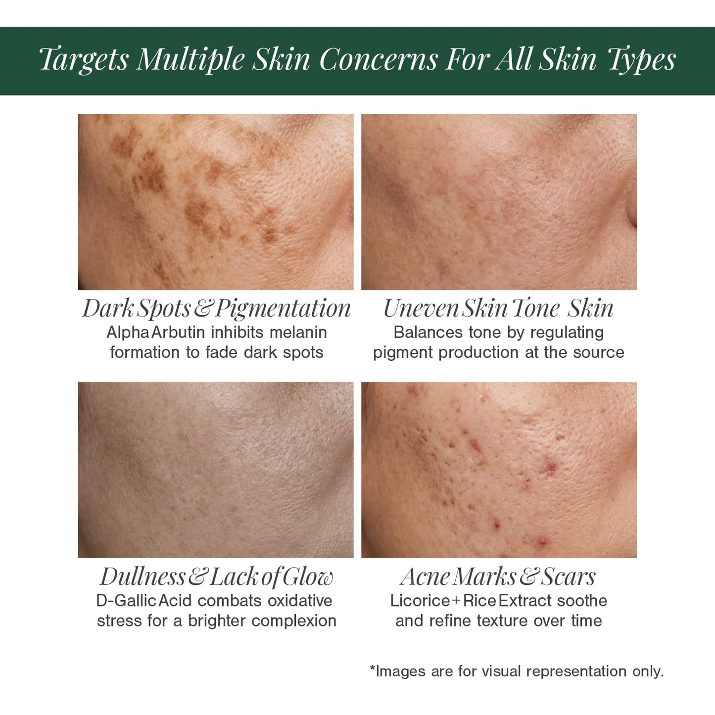 2% Alpha Arbutin + D-Gallic Acid Natural Face Serum