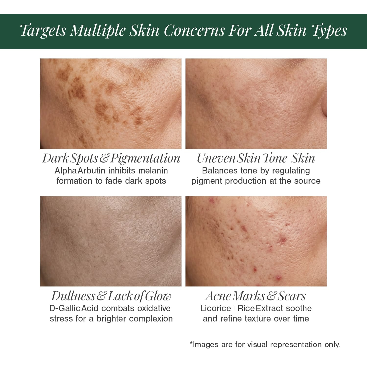 2% Alpha Arbutin + D-Gallic Acid Natural Face Serum