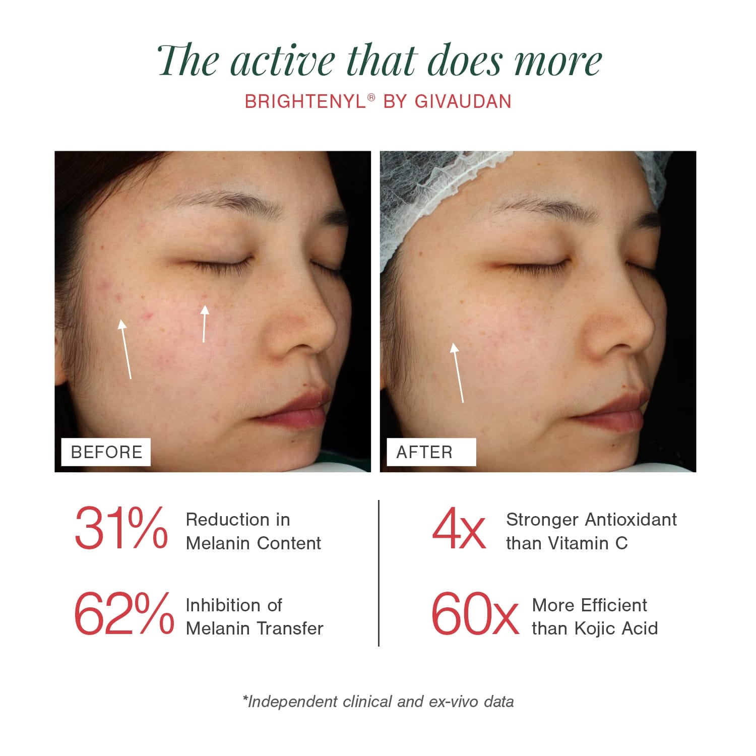 2% Alpha Arbutin + D-Gallic Acid Natural Face Serum