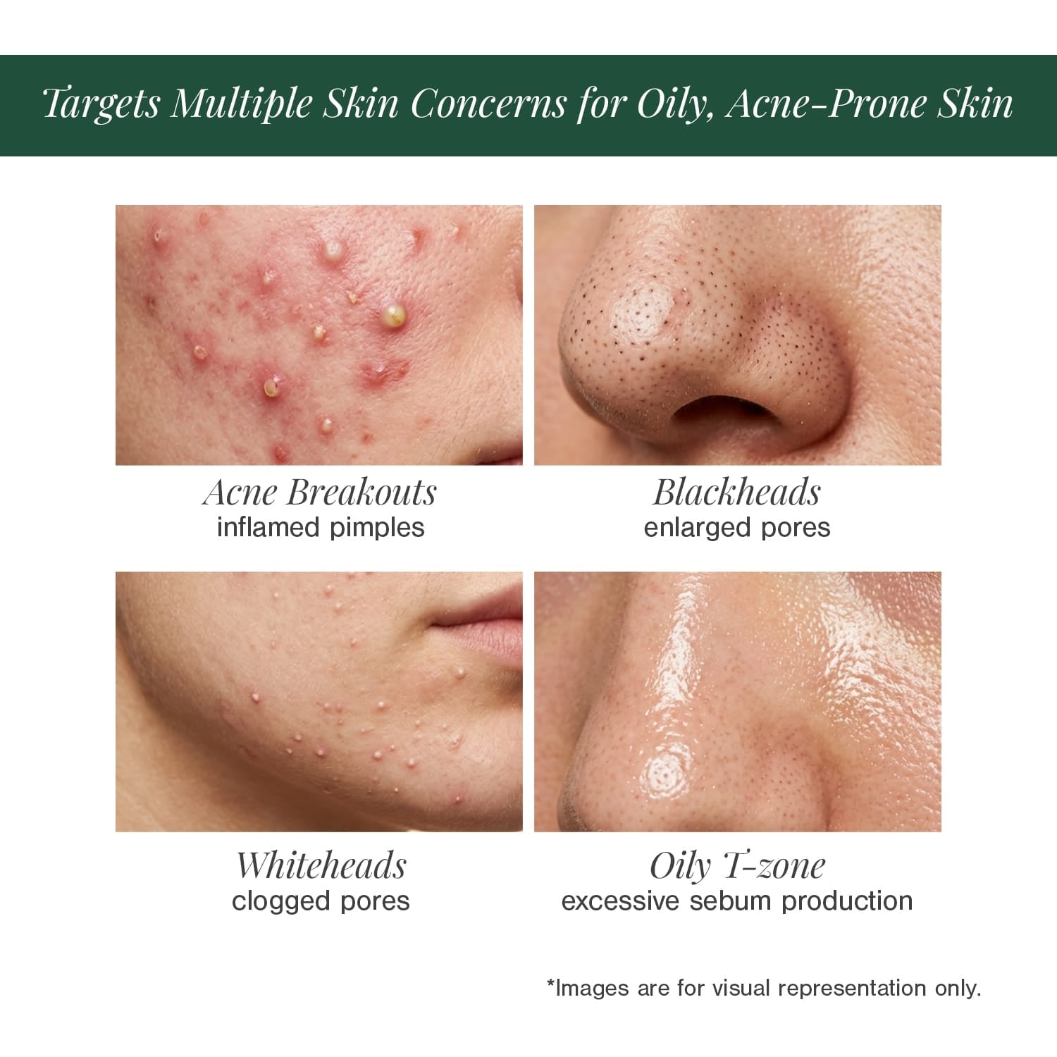 2% BHA + Zinc PCA Face Serum