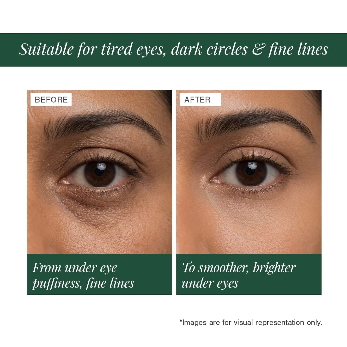 3% Caffeine + Peptides Eye Serum
