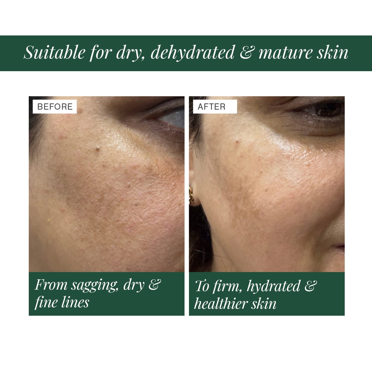 3% Ceramide Complex + Copper Peptide Face Serum