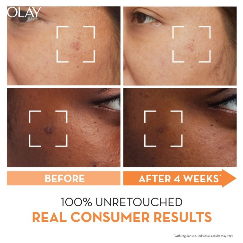 Olay Vitamin C Kit For 2x Glow - Cream With Free Cleanser - Swadesiicart