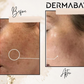 Dermabay Skin Brightening Face Serum With Kojic Acid & Alpha Arbutin | Swadesiicart