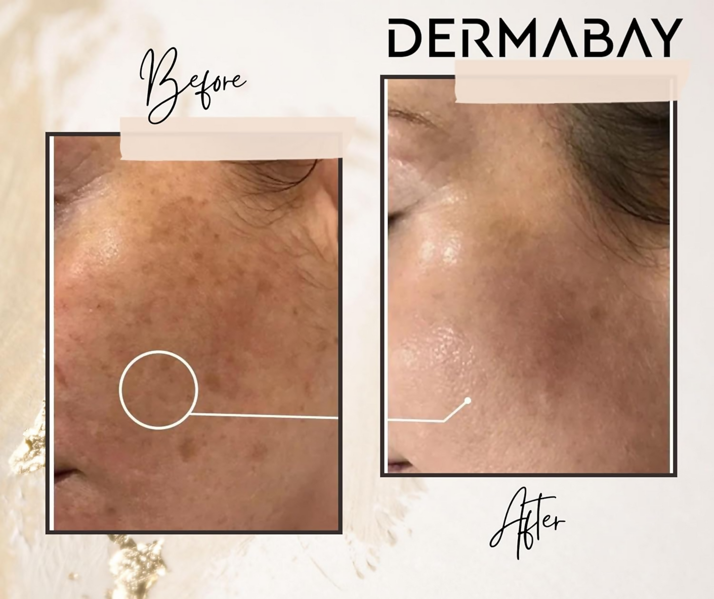 Dermabay Skin Brightening Face Serum With Kojic Acid & Alpha Arbutin | Swadesiicart