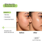 Nature Derma 1% Natural Biome-Boost Moisturizer With CICA | Swadesiicart