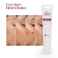 Alite Spots Reduction Cream with 5X Enhanced Absorption