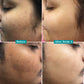 Pilgrim 10% Vitamin C Face Serum For Daily Brightness 5% Niacinamide