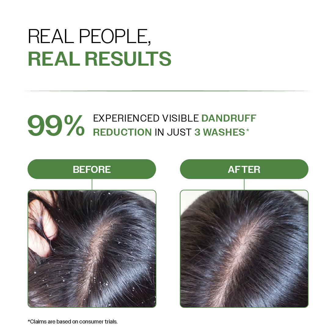 Bare Anatomy Expert Anti-Dandruff Shampoo with Salicylic Acid & Biotin | Swadesiicart