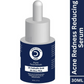 Dermistry 2% Salicylic Acid 2% Zinc Face Serum For Oily Acne Prone Skin Blackhead & Whiteheads Scars - Swadesiicart