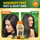 Action Pharma Shampoo Anti-Dandruff Enriched With Neem