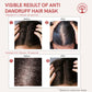 Ivory Natural Dandruff Hair Mask - Scalp Wellness, Assists With Dandruff For Both Men & Women | Swadesiicart