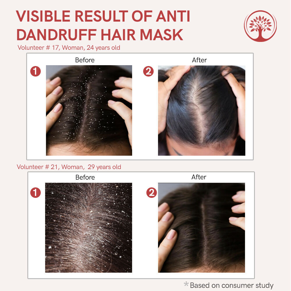 Ivory Natural Dandruff Hair Mask - Scalp Wellness, Assists With Dandruff For Both Men & Women | Swadesiicart