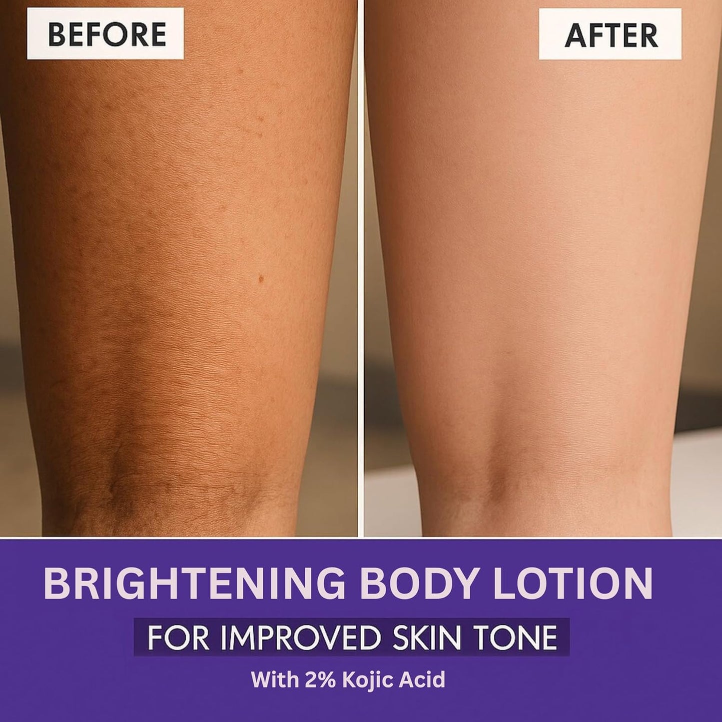 Bake 2% Kojic Acid Body Lotion SPF 30 | Swadesiicart