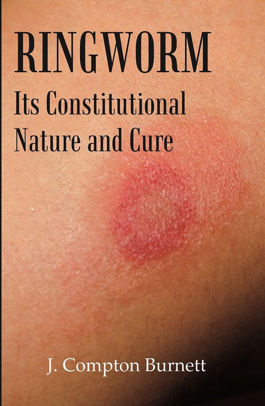 Ringworm: Its Constitutional Nature and Cure - Gyan Books - Swadesiicart