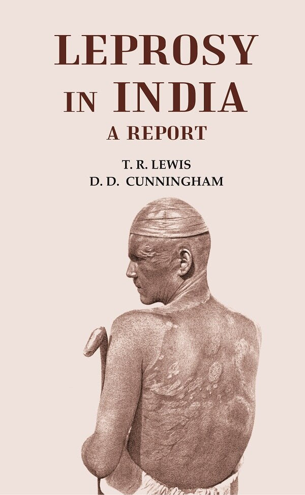 Leprosy in India - Gyan Books - Swadesiicart