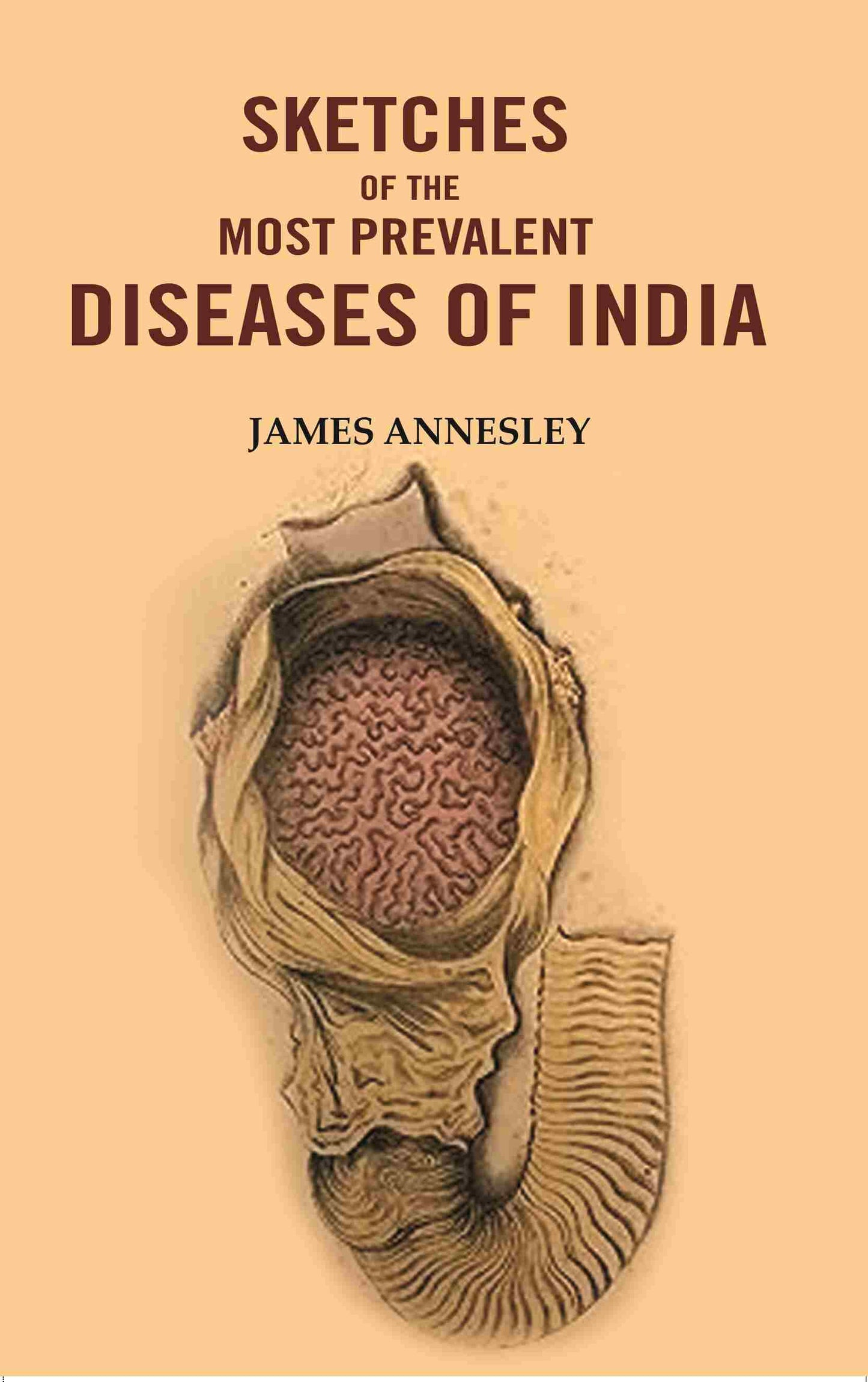 Sketches of the Most Prevalent Diseases of India - Gyan Books - Swadesiicart