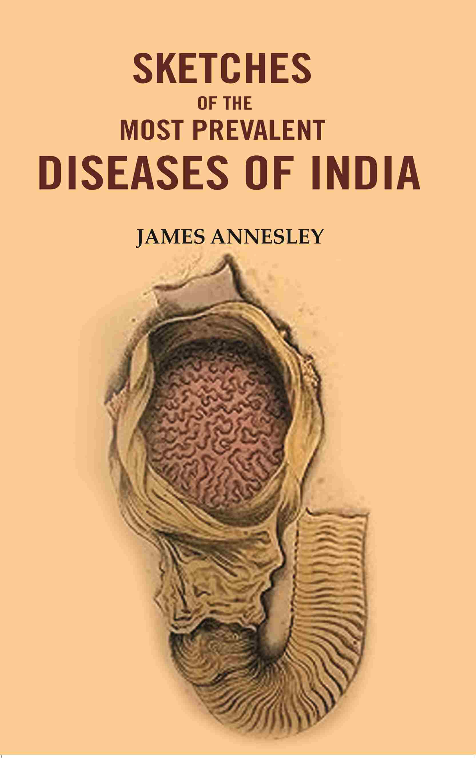 Sketches of the Most Prevalent Diseases of India - Gyan Books - Swadesiicart