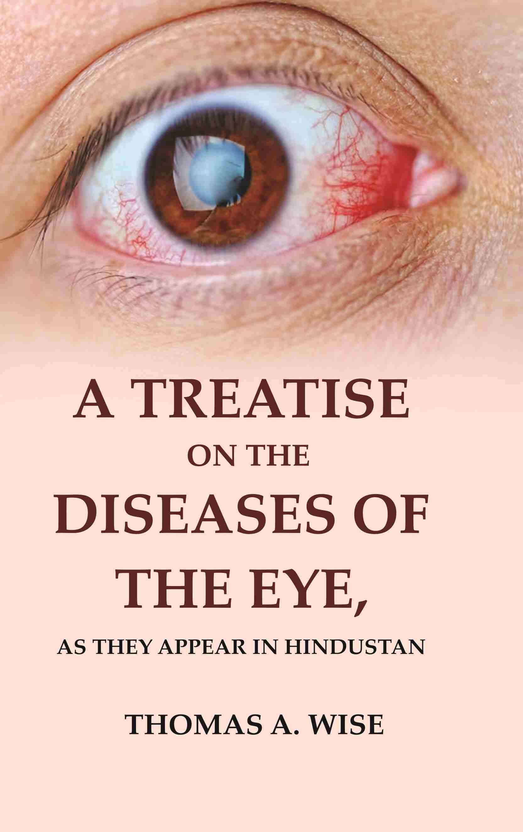 A Treatise on the Diseases of The Eye: As they appear in Hindustan - Gyan Books - Swadesiicart