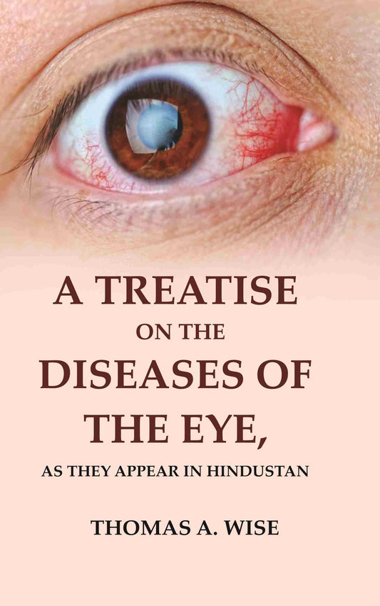 A Treatise on the Diseases of The Eye: As they appear in Hindustan - Gyan Books - Swadesiicart