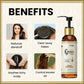 myUpchar Ayurveda KeshArt Bhringraj Anti-Dandruff Shampoo | Swadesiicart