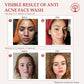 Ivory Natural Acne & Dark Spot Face Wash For Moisturize, Replenish, And Promote Skin Clarity | Swadesiicart
