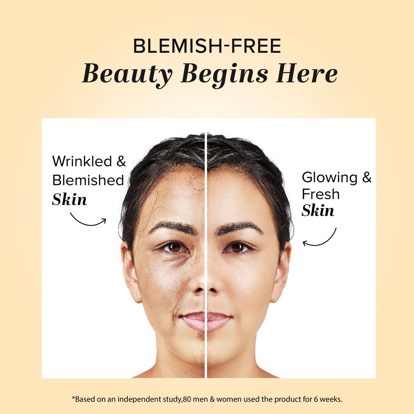 Khadi Natural Herbal Anti Blemish Cream - 50gm