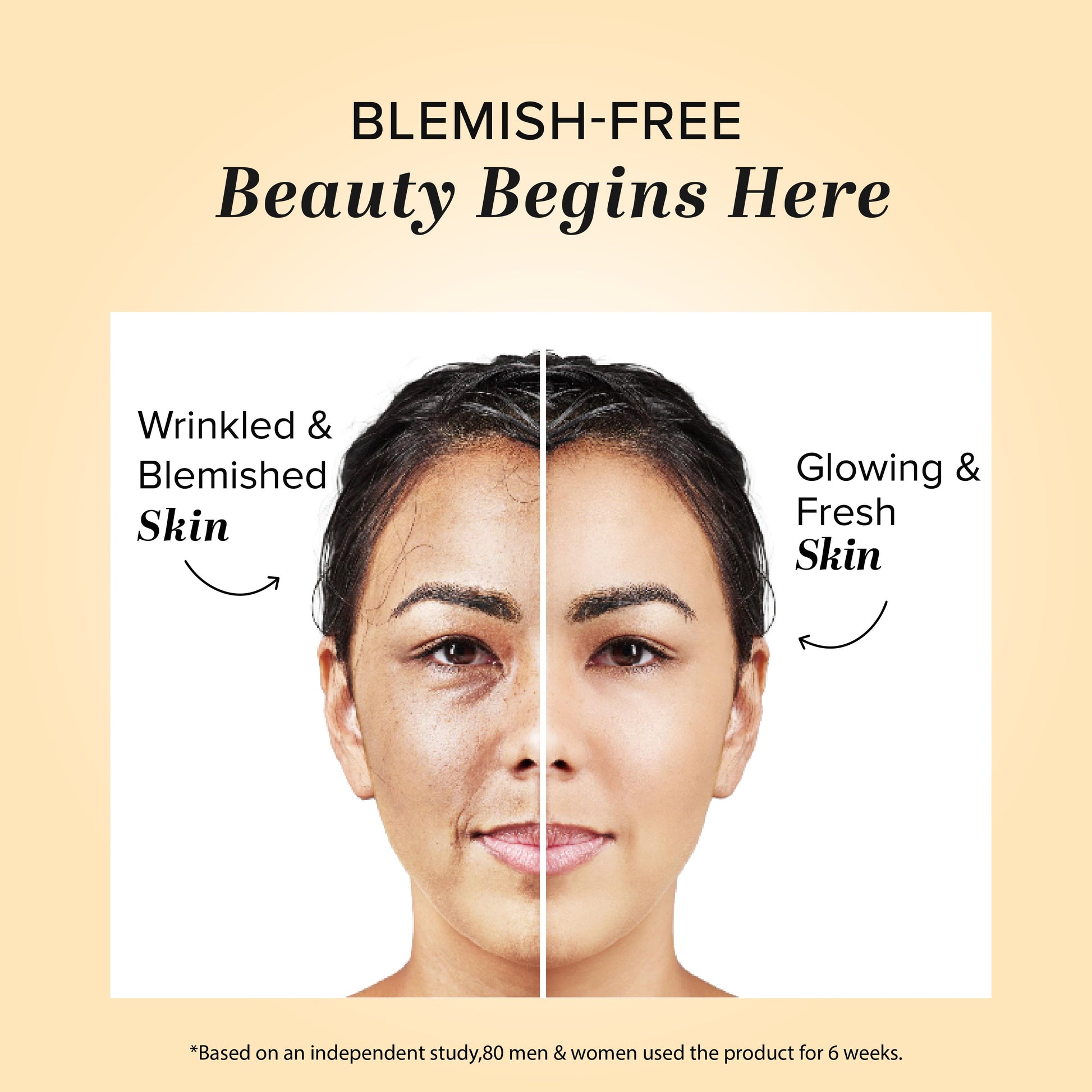 Khadi Natural Herbal Anti Blemish Cream - 50gm