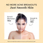 Khadi Natural Herbal Acne Pimple Cream - 50gm