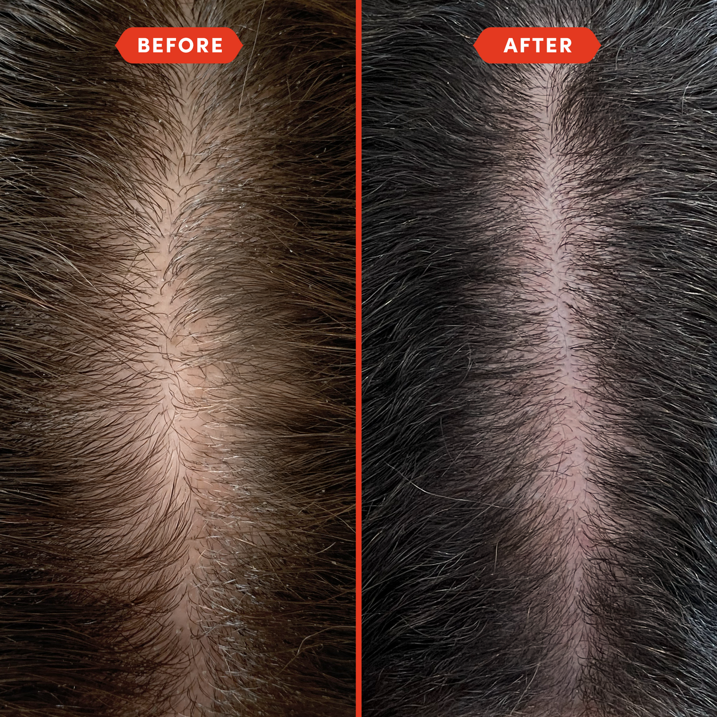 Strengthen & Shine Hair Oiling Duo